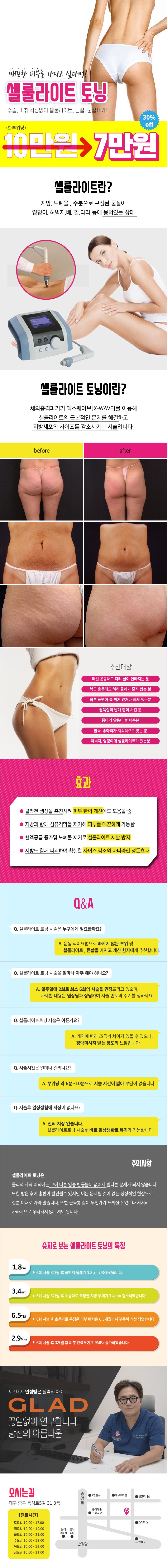 대구 글래드성형외과의 셀룰라이트 토닝 시술로 매끈한 바디라인을 만드는 특별 프로모션 7만원