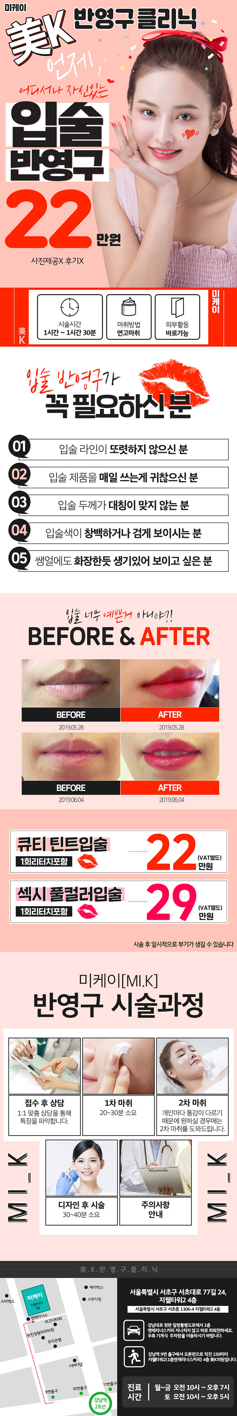 강남 미케이의원의 섹시큐티 입술반영구화장 시술 - 창백한 입술을 생기있고 매력적인 입술로 바꾸는 22만원 특가 이벤트