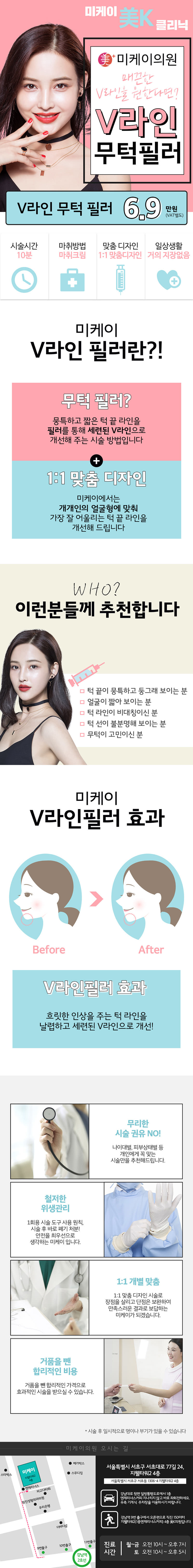 강남 미케이의원의 V라인 무턱필러 시술로 6.9만원에 자연스러운 V라인 완성