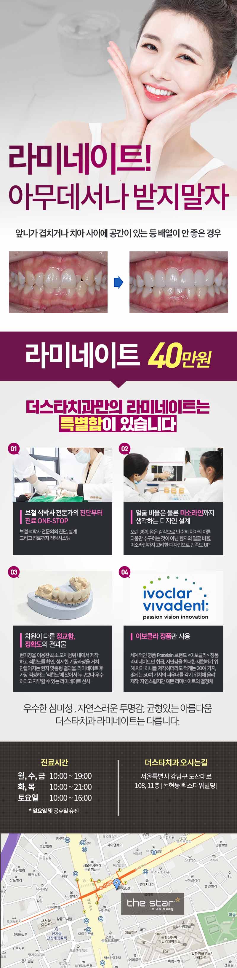 서울 신사동 더스타치과의 라미네이트 시술 40만원 특가 홍보 - 연세대 보철전문의의 고퀄리티 심미치료