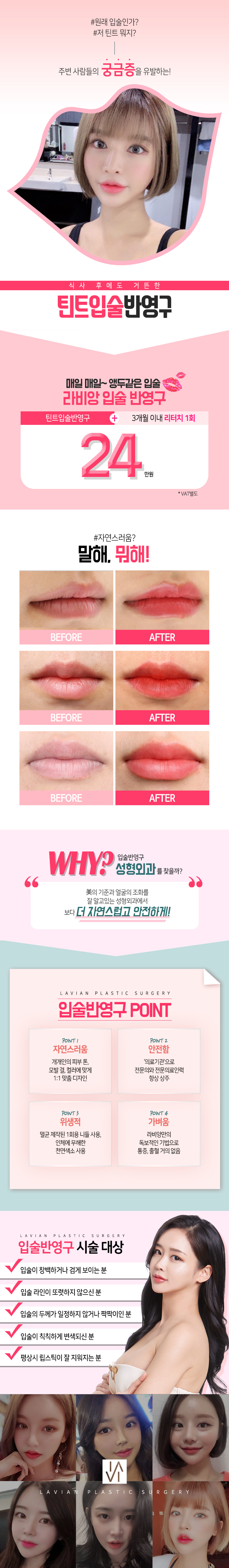 라비앙성형외과의 틴트입술 반영구 시술로 자연스럽고 선명한 입술색 연출 (24만원)