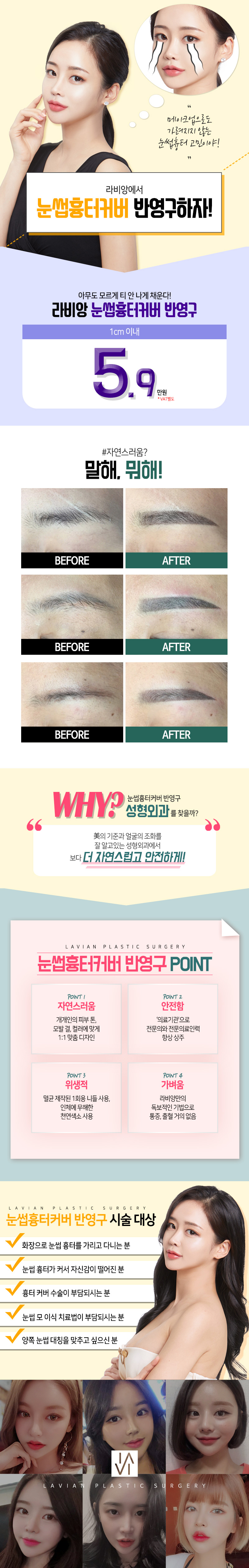 메이크업으로도 가려지지 않는 눈썹 흉터를 5.9만원의 합리적인 가격으로 반영구 시술을 통해 자연스럽게 커버하는 시술