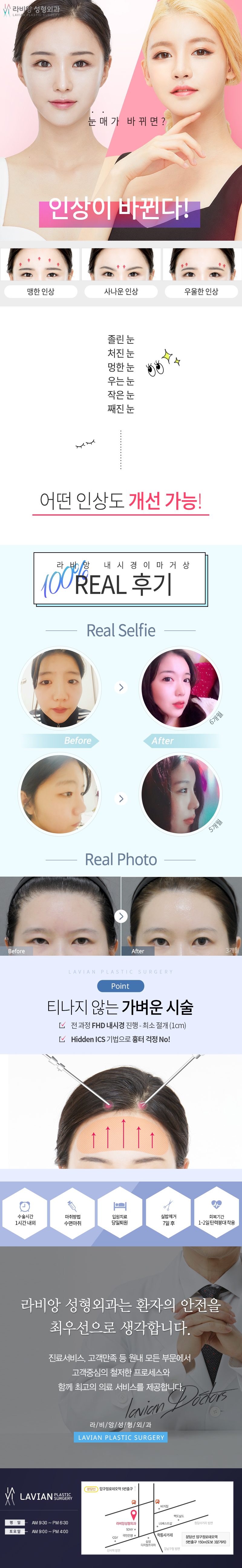 압구정 라비앙성형외과의 내시경이마거상 시술로 이마리프팅과 처진 눈매를 동시에 개선하는 300만원 프로모션