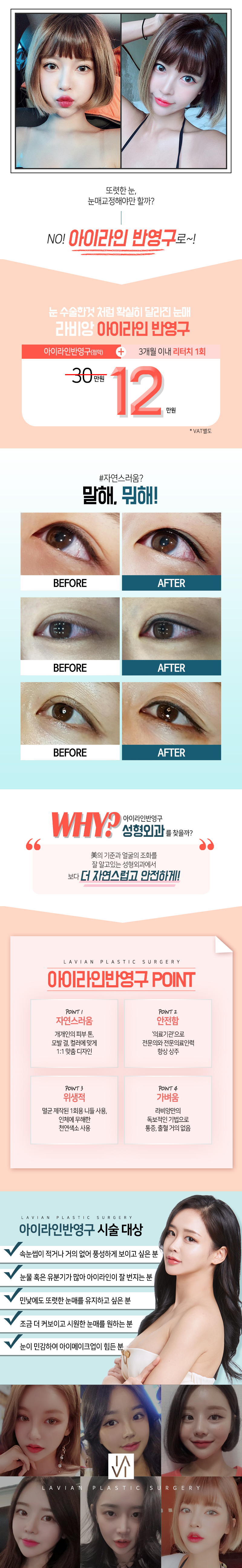 라비앙성형외과의 아이라인 반영구 시술로 수술없이 선명하고 자연스러운 눈매 완성 (12만원)