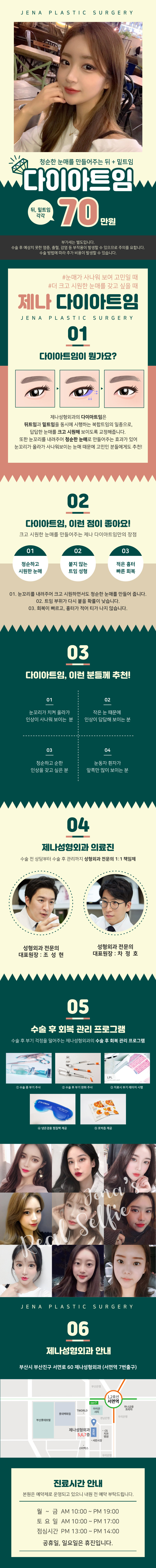 부산 서면 제나성형외과의 눈꼬리 다이아트임 시술로 사나운 인상을 청순하고 시원한 눈매로 개선하는 70만원 이벤트