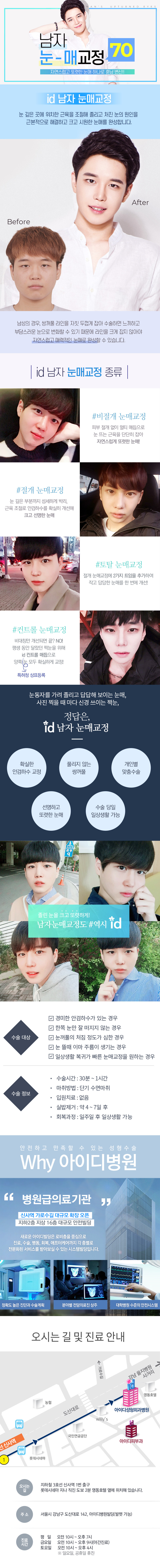 서울 신사동 아이디병원의 남자 눈매교정 70만원 특가 시술 홍보