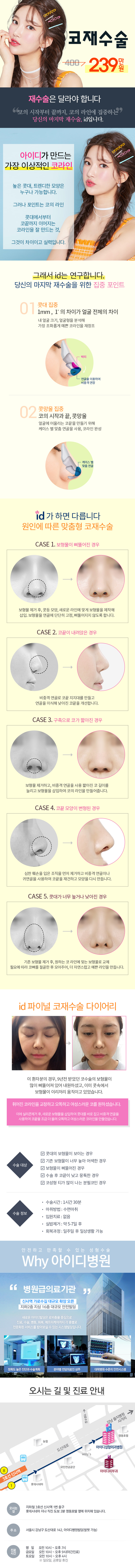 아이디병원의 코재수술 패키지 239만원 특가 프로모션으로, 실패한 코수술을 교정하는 전문 시술