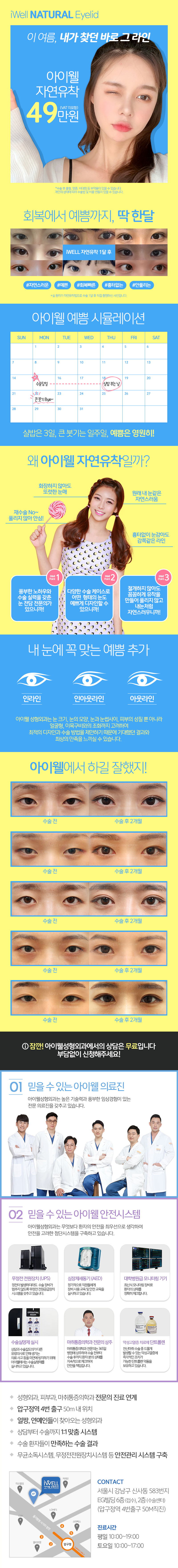 서울 압구정 아이웰성형외과의 자연스러운 쌍꺼풀 수술 49만원 특가 프로모션