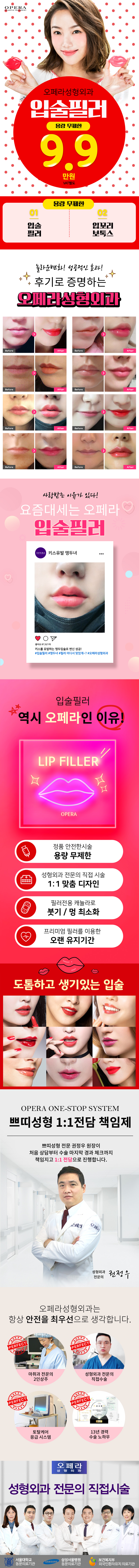 강남 오페라성형외과의 입술필러와 입꼬리보톡스 무제한 시술 9.9만원 특가 프로모션