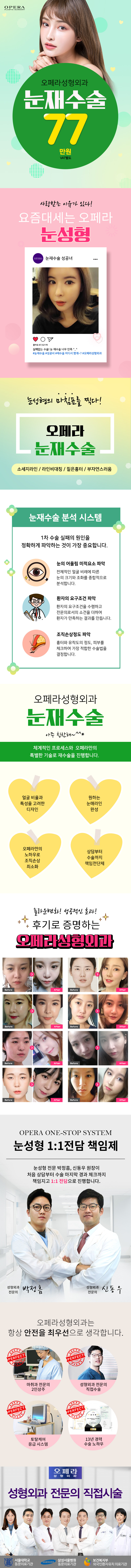 서울 강남 오페라성형외과의 77만원 눈 재수술 프로모션 - 실패없는 마지막 눈 성형 솔루션