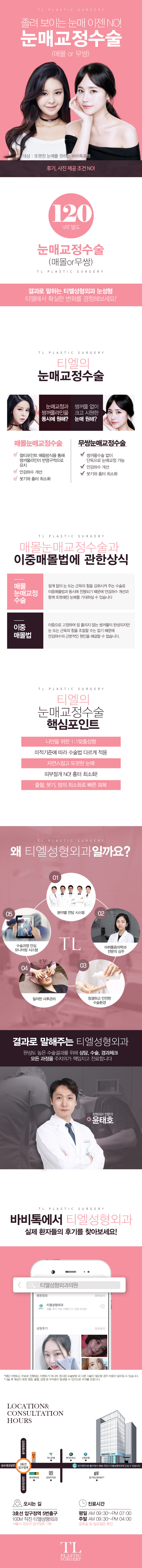 압구정 티엘성형외과의 매몰/무쌍 눈매교정수술 120만원 특가 프로모션