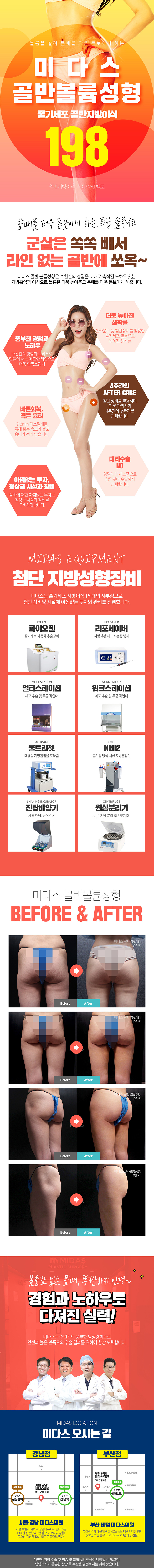 서울 강남에 위치한 미다스의원의 미다스골반볼륨성형은 탄력없고 볼륨없는 골반을 개선하여 더욱 돋보이는 몸매를 만들어주는 골반솔루션입니다.
