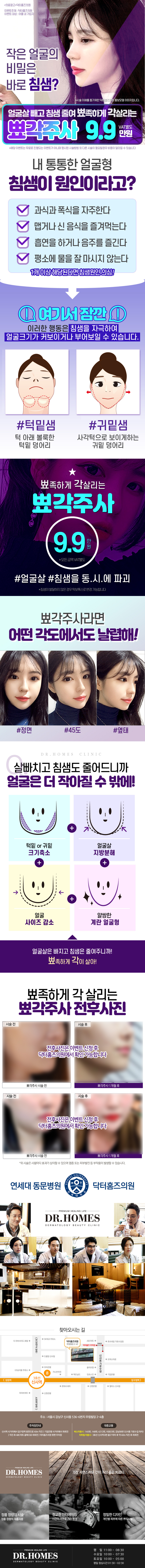 뾰족하게 각을 살리는 침샘보톡스 뾰각주사 9.9만원 특가 프로모션