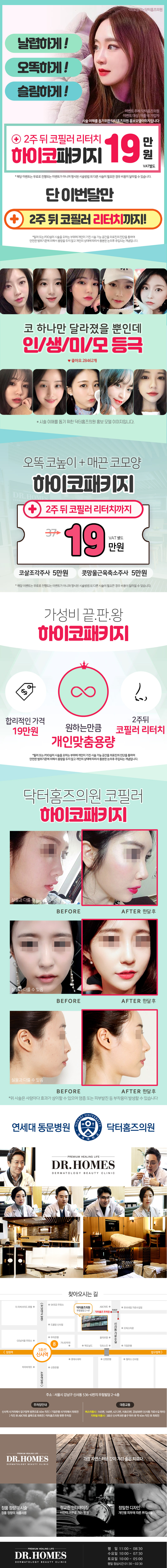 닥터홈즈의원의 맞춤용량 하이코패키지로 19만원에 높아지는 코 성형 시술