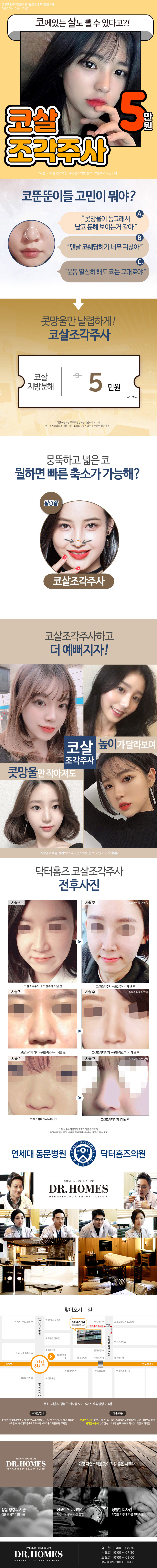 서울 신사동 닥터홈즈의원의 코살조각주사 5만원 프로모션, 콧망울살 지방분해 시술