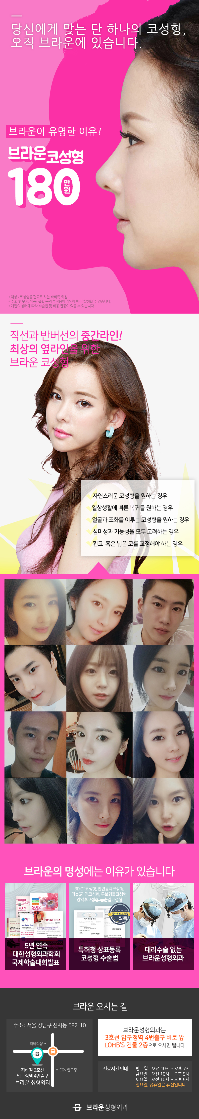 서울 압구정에 위치한 브라운성형외과의원의 콧대+코끝 성형 180만원 특별 프로모션