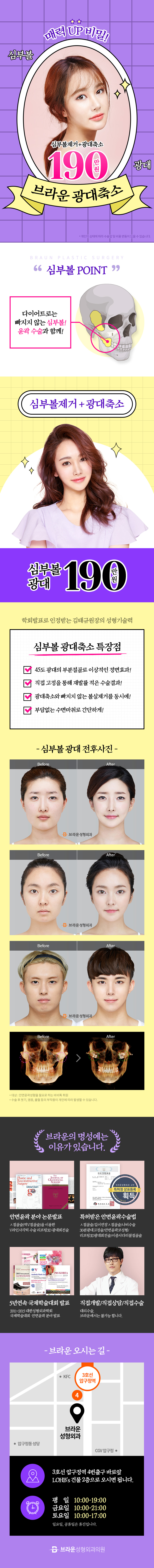 서울 압구정 브라운성형외과의 광대축소 190만원 특별 프로모션 안내