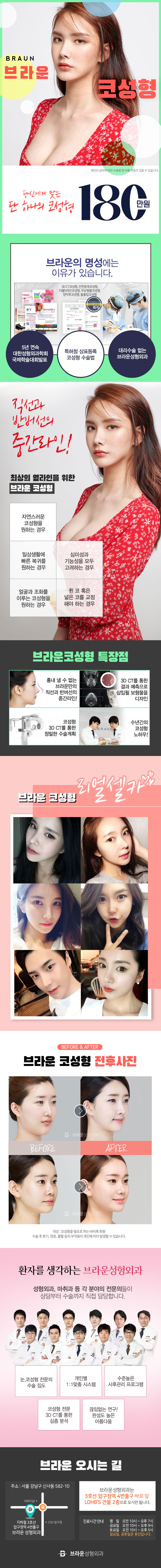 압구정 브라운성형외과의 180만원 코성형 패키지로 콧대, 코끝 교정을 통한 자연스러운 코 라인 형성