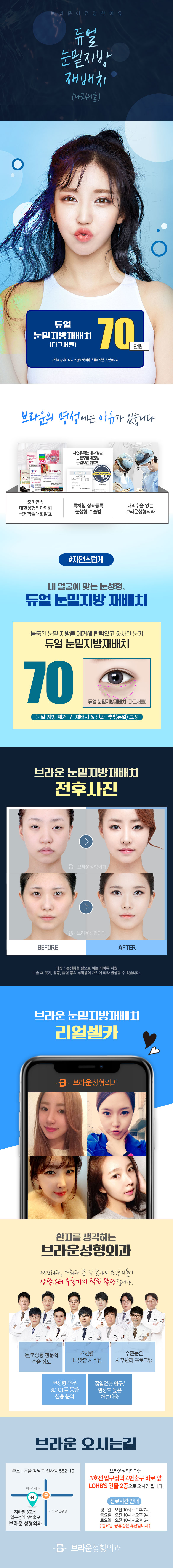 서울 압구정 브라운성형외과의 70만원 듀얼눈밑지방재배치 시술로 다크서클 개선과 탄력 증진을 제공하는 프로모션