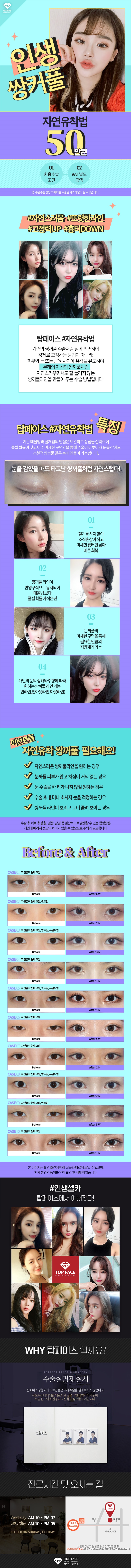 서울 압구정 탑페이스성형외과의 50만원 인생쌍수 이벤트 홍보 컨텐츠