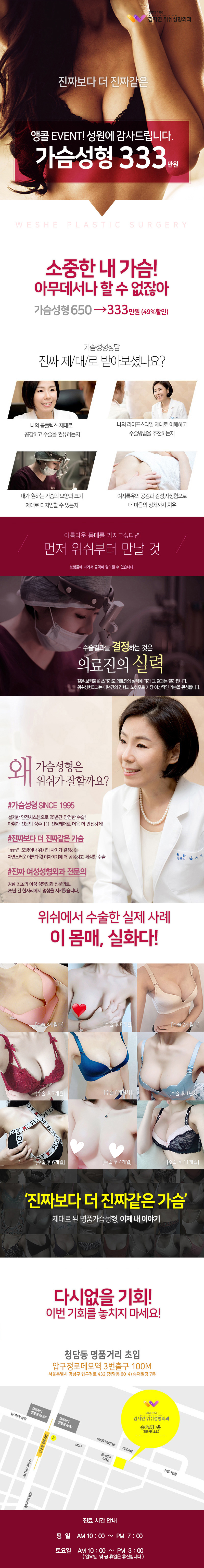 압구정 김지연위쉬성형외과의 27년 노하우로 진행하는 가슴성형 333만원 특별 이벤트
