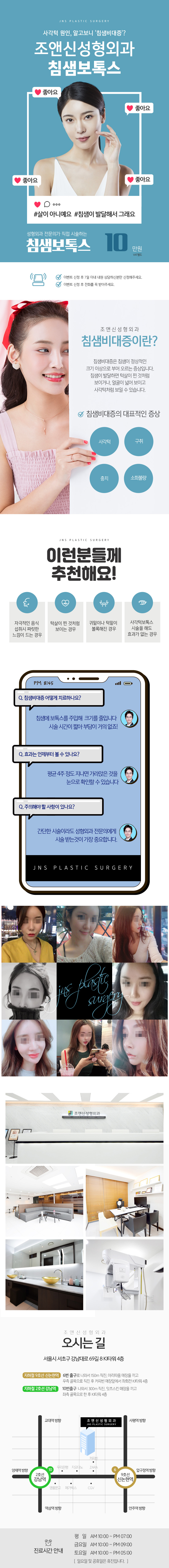 강남 조앤신성형외과의원에서 제공하는 침샘보톡스 시술, 성형외과전문의 직접 시술, 10만원 특가