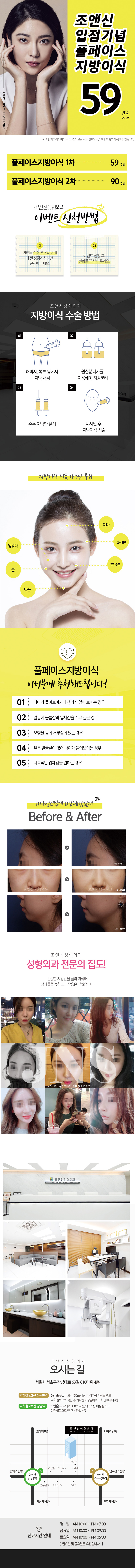 서울 강남 조앤신성형외과의원의 풀페이스 지방이식 시술 59만원 특가 프로모션
