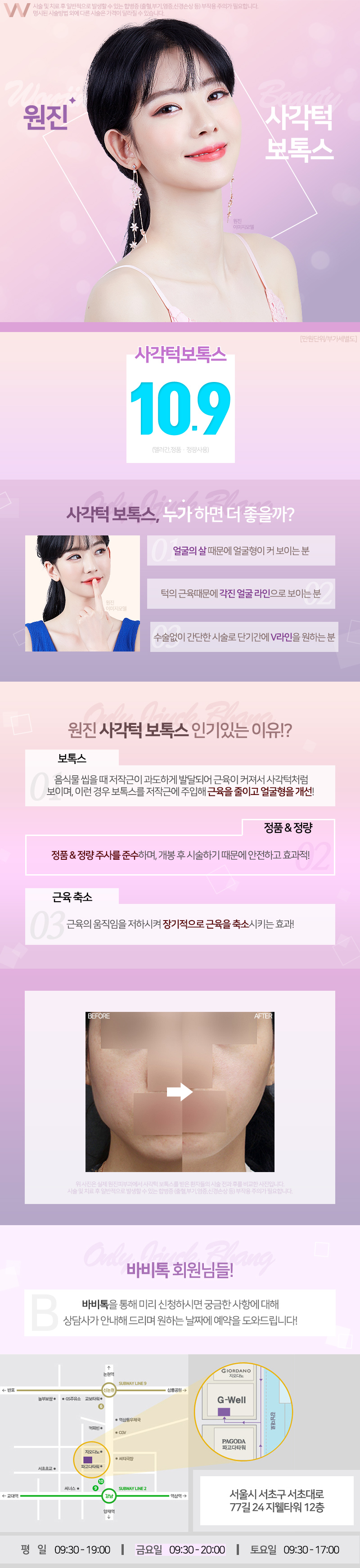 강남 원진피부과의 앨러간 보톡스를 이용한 사각턱 교정 시술(10.9만원)