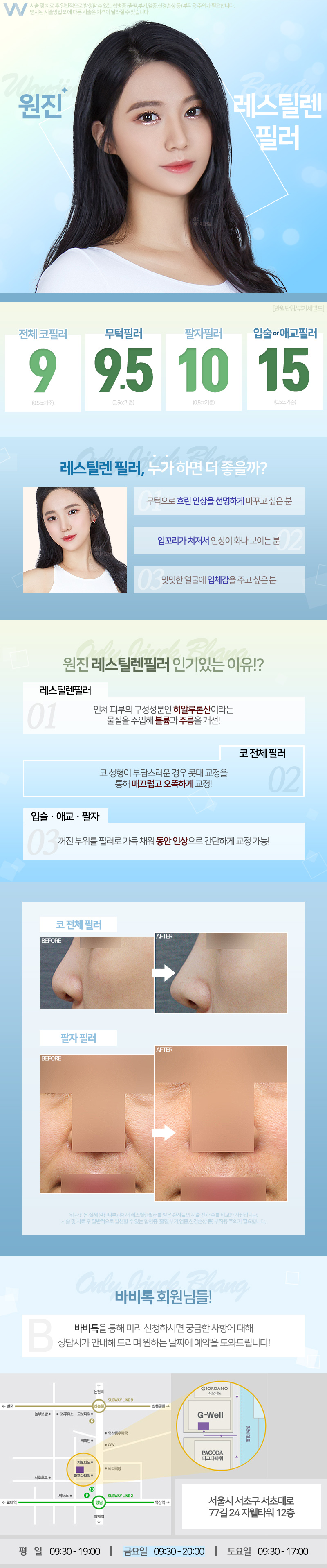 강남 원진피부과의 레스틸렌 필러 9만원 특가 이벤트로 빠른 시간 내 볼륨감 개선