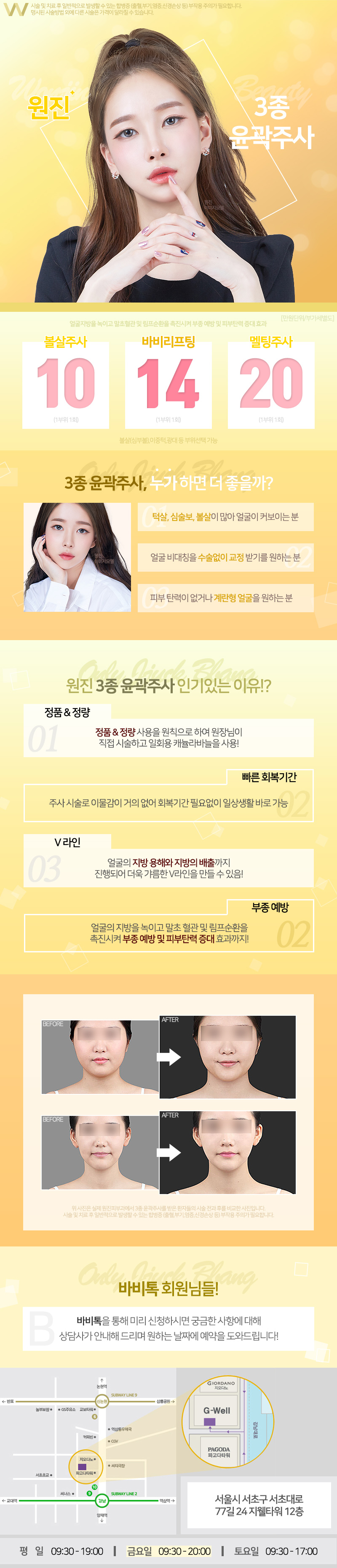 강남 원진피부과의 3종 윤곽주사 시술로 10만원에 예쁜 V라인 얼굴형 만들기