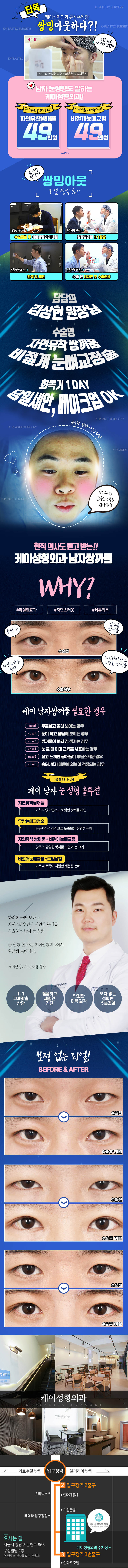 압구정 케이성형외과의 남성 맞춤형 쌍꺼풀 수술 '케이쁨 남자쌍꺼풀' 49만원 특가 프로모션
