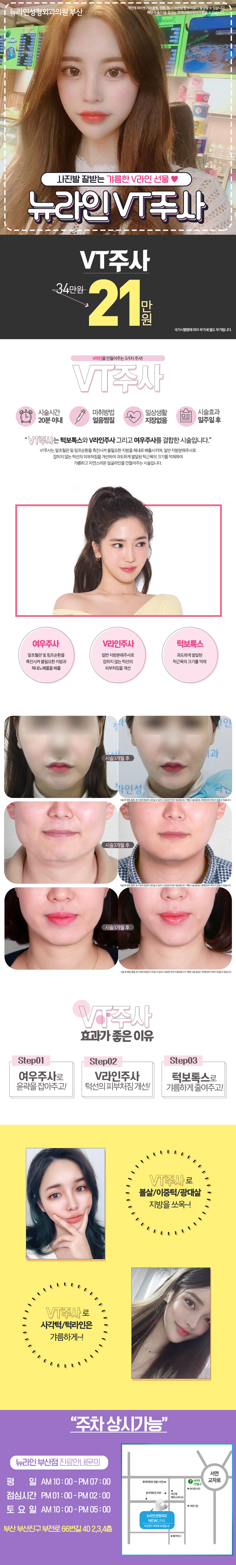 부산 서면 뉴라인성형외과의 수술 없이 V라인을 만들어주는 3가지 VT주사 패키지 시술(21만원)