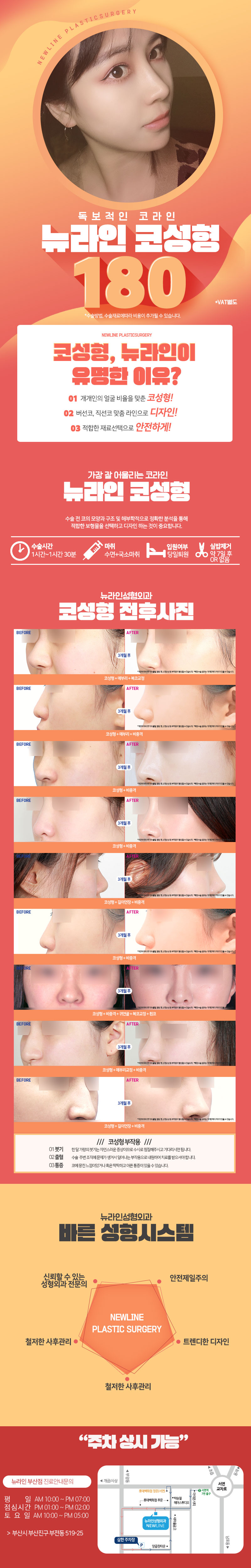 부산 서면 뉴라인성형외과의 180만원 코성형 시술 프로모션, 독보적인 코라인 완성을 약속