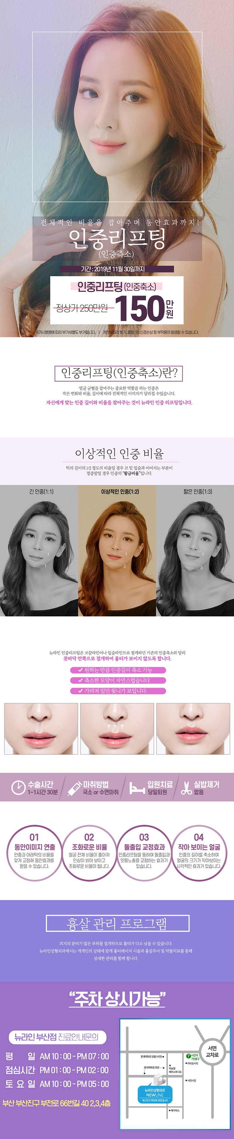 부산 서면 뉴라인성형외과의 흉터 없는 인중축소 시술(150만원) - 개인별 맞춤 황금비율로 동안 효과 제공