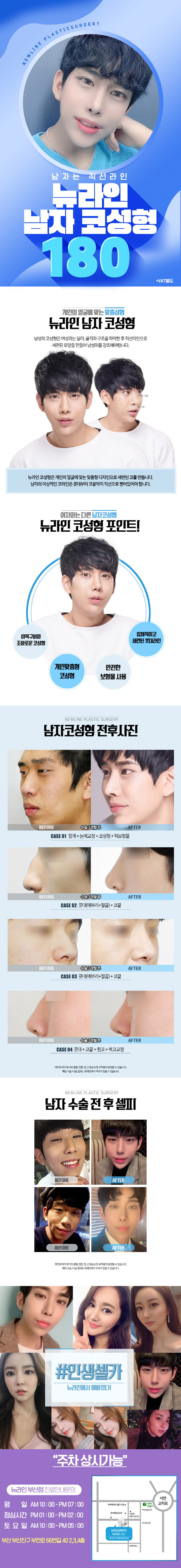 부산 서면 뉴라인성형외과의 남자 코 성형 시술로, 180만원에 자연스러운 직선 라인의 이상적인 남성 코 라인을 완성하는 프로그램