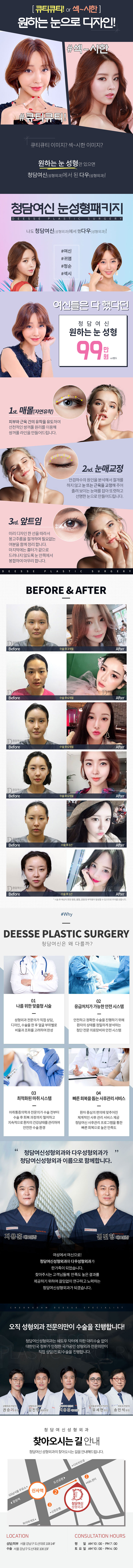 청담여신성형외과의원의 한가위 눈성형 패키지: 쌍꺼풀, 눈매교정, 앞트임 시술을 99만원에 제공하는 특별 프로모션
