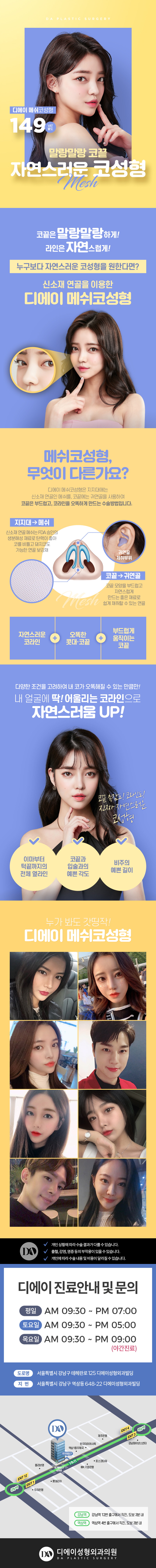149만원으로 자연스럽고 말랑말랑한 코끝을 만드는 DA성형외과의 메쉬코 시술