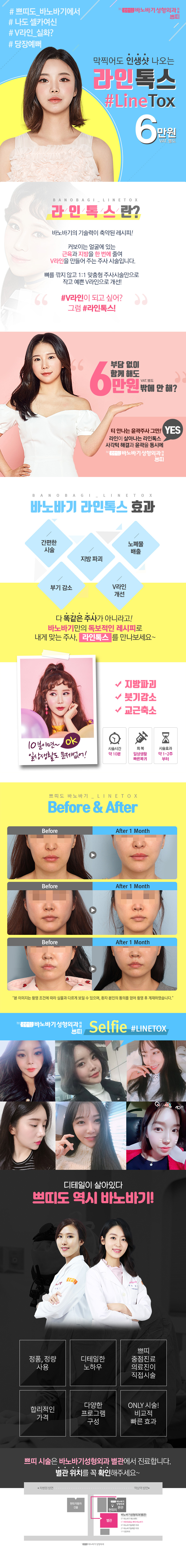 바노바기성형외과의 V라인톡스는 수술 없이 6만원으로 갸름한 V라인을 만들 수 있는 보톡스 시술