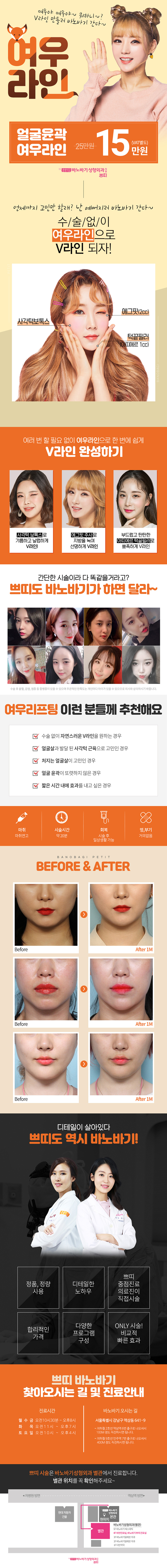 바노바기성형외과의 여우라인 리프팅 시술: 수술 없이 자연스러운 V라인을 완성하는 15만원 프로모션
