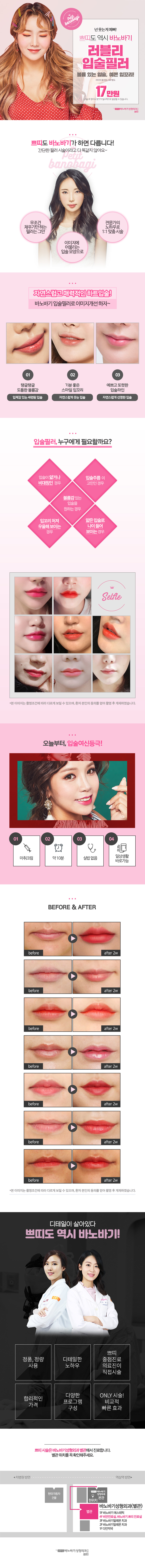 서울 교대 바노바기성형외과의원의 17만원 입술필러 이벤트로, 자연스러운 볼륨감 있는 입술 형성을 위한 시술