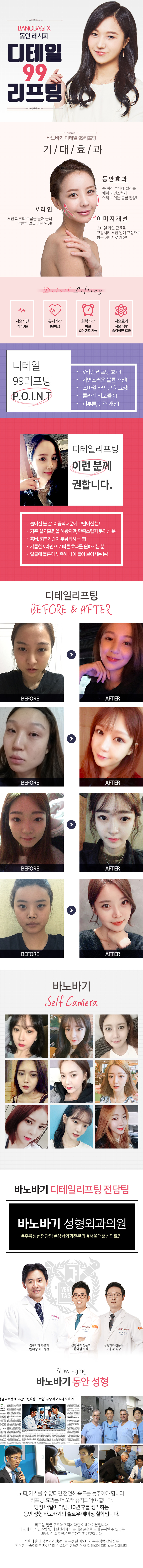 바노바기성형외과의 디테일 99 리프팅: V라인 개선과 동안효과를 위한 99만원 특가 프로그램