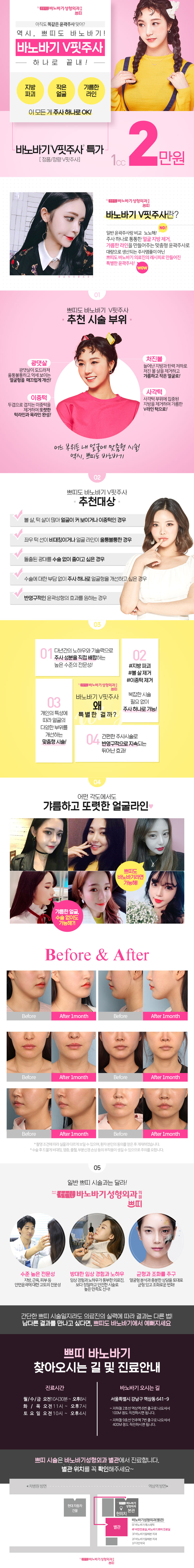 바노바기성형외과의 V핏주사는 2만원의 합리적인 가격으로 얼굴 지방 감소와 V라인 교정을 제공하는 미용 시술
