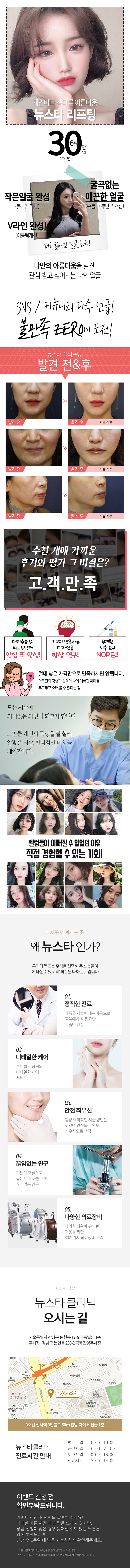 서울 신사동 뉴스타의원의 실리프팅 시술 30만원 특가 프로모션, 6줄 시술로 V라인 완성