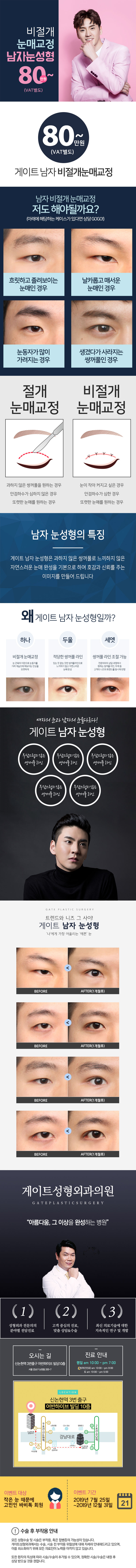 게이트성형외과의 남자 눈성형 80만원 특별 프로모션 - 비절개 눈매교정으로 자연스러운 호감형 눈매 완성