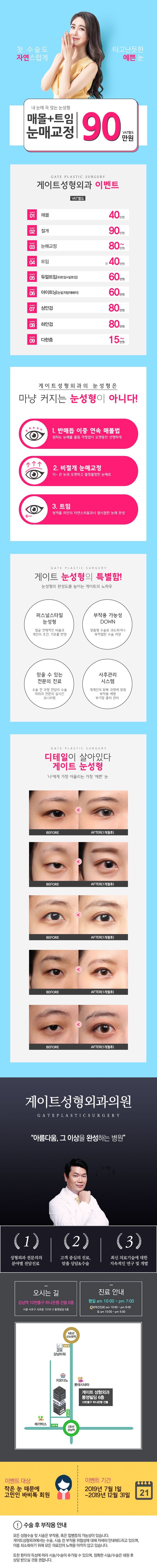 서울 강남 게이트성형외과의 매몰+트임+눈매교정 90만원 특가 패키지 시술