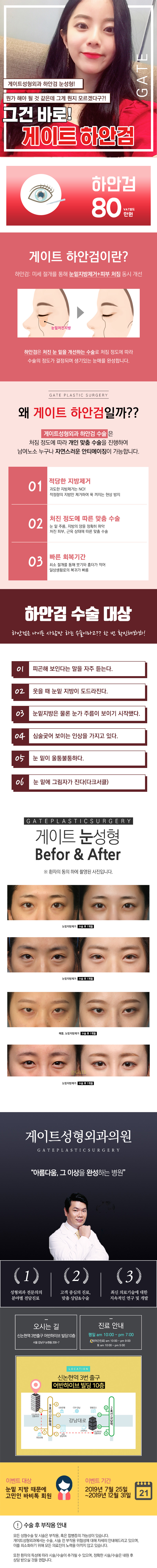 게이트성형외과의 하안검 수술(80만원)로 울퉁불퉁한 눈밑 고민 해결 및 생기있는 눈매 완성