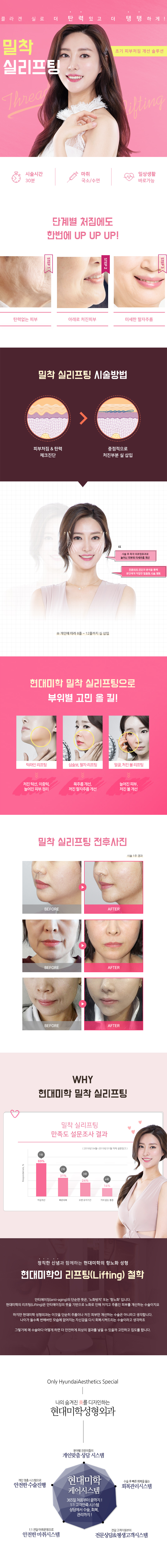 현대미학성형외과의 49만원 특가 밀착리프팅 시술로 처진 피부, 이중턱, 주름 개선 효과를 당일 확인 가능