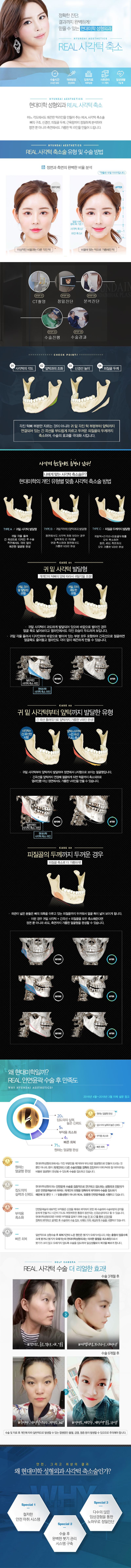 현대미학성형외과의원의 추가비용 없는 380만원 FULL사각턱축소 시술 패키지