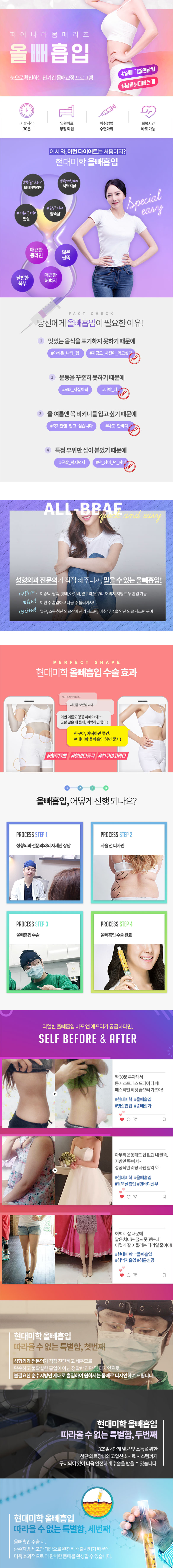 현대미학성형외과의 45만원 순수지방 올뺴흡입 시술 - 비키니 시즌 체형관리 프로모션