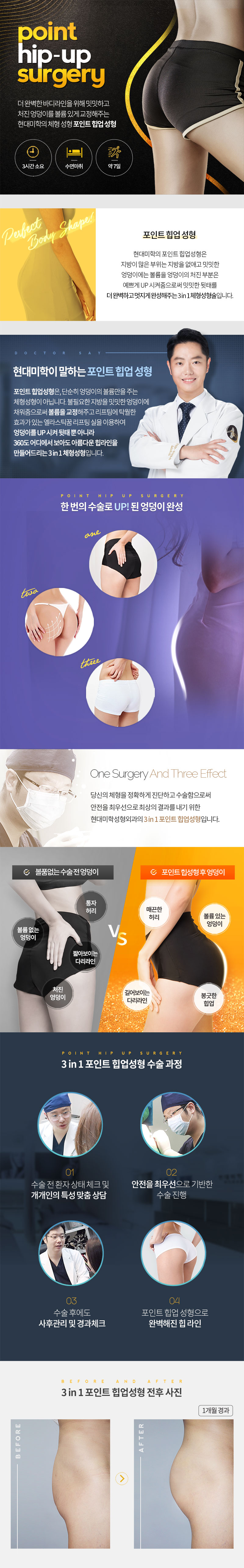 현대미학성형외과의 3 in 1 포인트힙업성형은 하나의 수술로 처진엉덩이, 볼륨부족, 힙업 효과를 동시에 개선하는 500만원대 특화 시술입니다.